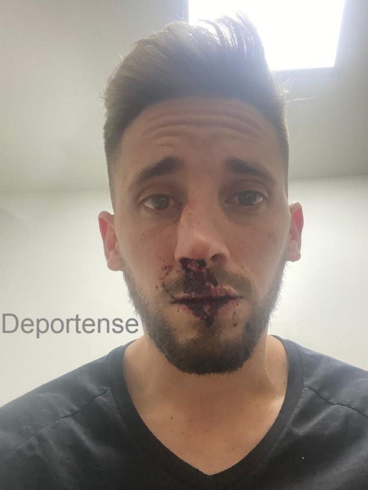 Así quedó Nicolas Morgantini tras los ataques de la barra de Estudiantes (@SC_ESPN)